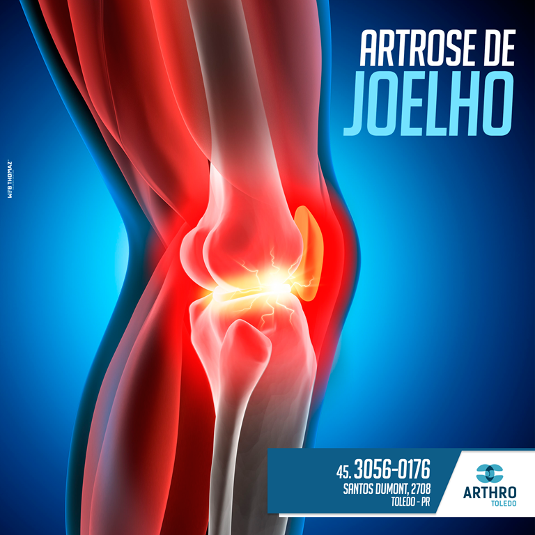 1503597828_Arthro-09-08 (Copy).png
